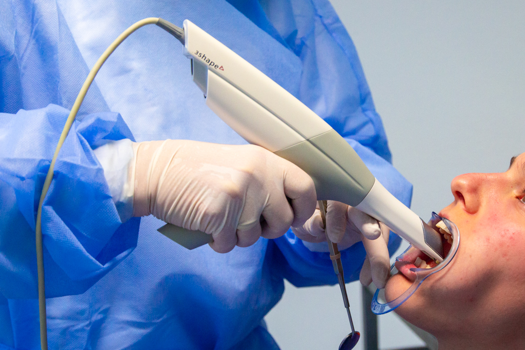 Scanner intraorale usato tipicamente per protesi presso lo studio Dentistio Subiaco Salgarello